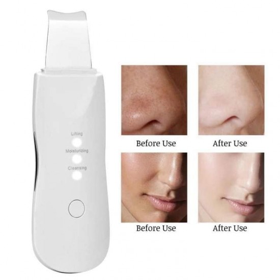 Ultrasonic skin scrubber to remove pimples and deep fat