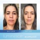 cellular tissue regeneration serum Luminesce