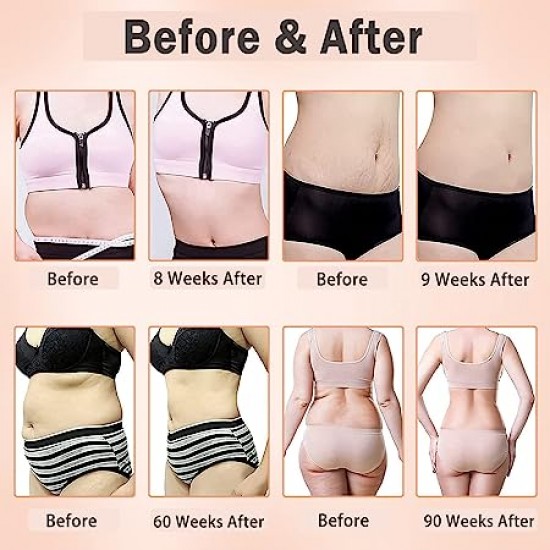 cavitation device for slimming and fat loss