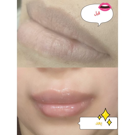 Mesoskin PINKY LIPS and mini filler 5 ml ampoule