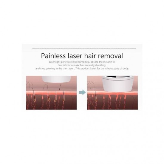 Kemei Hair Removal Laser Epilator