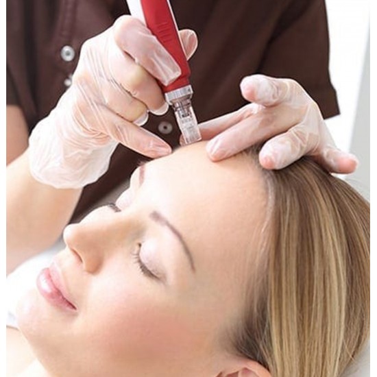 Enzo Professional Microneedling Therapy Pen