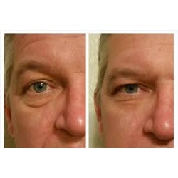 Jeunesse Instantly Ageless 25 Vials