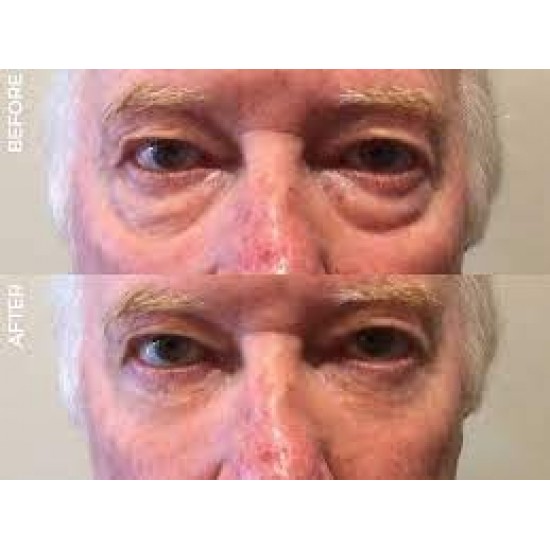 Jeunesse Instantly Ageless 25 Vials